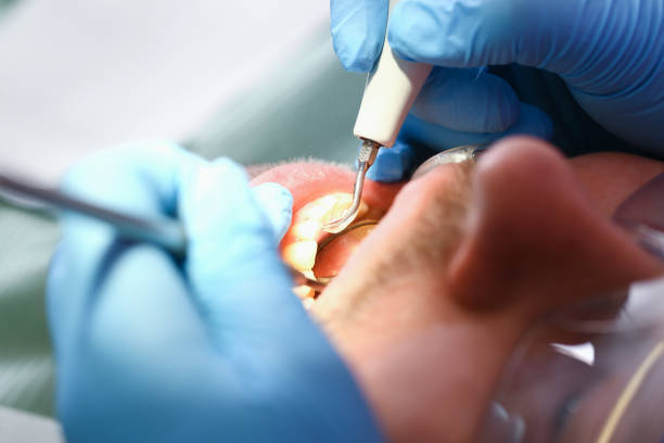 Best Emergency Denture Repair in Darby, PA